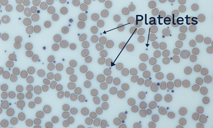 platelets in blood surrounded by red blood cells